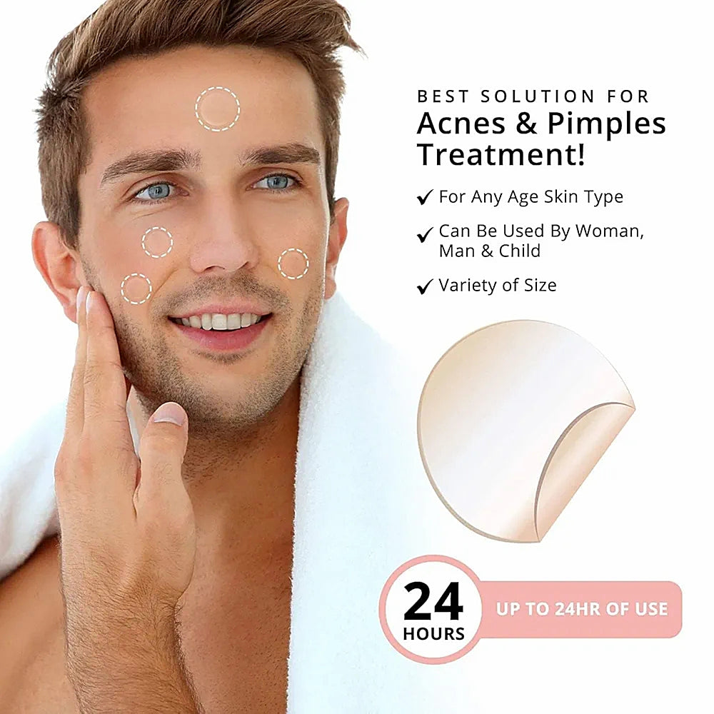 72Pcs Invisible Removal Pimple Anti-Acne Hydrocolloid Patches Spots Marks Concealer Waterproof Repair Sticker