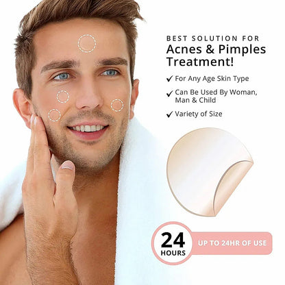 72Pcs Invisible Removal Pimple Anti-Acne Hydrocolloid Patches Spots Marks Concealer Waterproof Repair Sticker