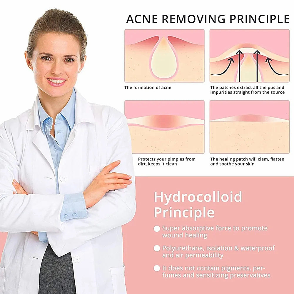 72Pcs Invisible Removal Pimple Anti-Acne Hydrocolloid Patches Spots Marks Concealer Waterproof Repair Sticker