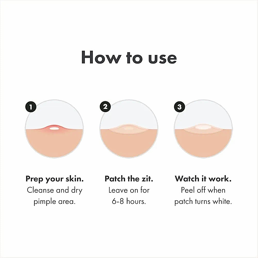 72Pcs Invisible Removal Pimple Anti-Acne Hydrocolloid Patches Spots Marks Concealer Waterproof Repair Sticker