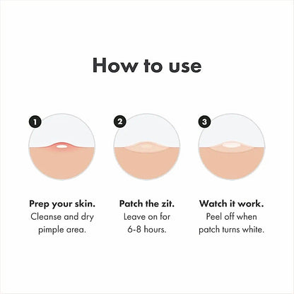 72Pcs Invisible Removal Pimple Anti-Acne Hydrocolloid Patches Spots Marks Concealer Waterproof Repair Sticker